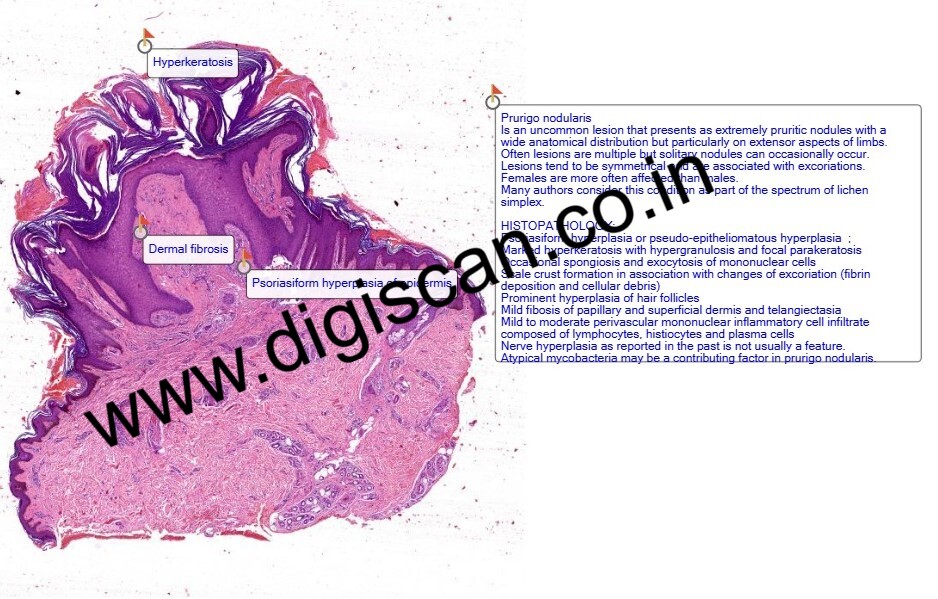 Dermatopathology Digital Slides Set (Skin Lesions, Infections & Tumors)